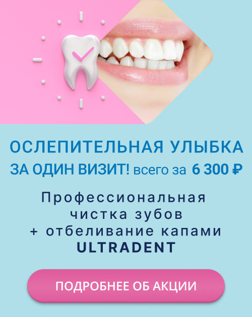 Профессиональная чистка зубов + щадящее отбеливание капами ULTRADENT 6300 ₽