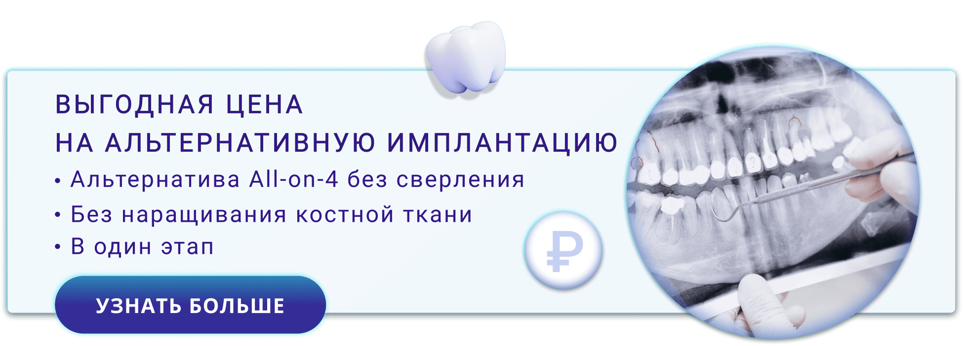 Выгодная цена на альтернативную имплантацию